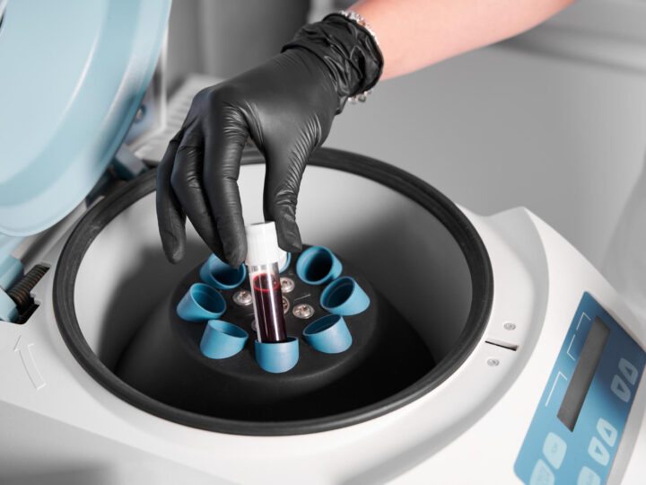 Diferenças entre centrífuga comum e centrífuga refrigerada em ambientes laboratoriais